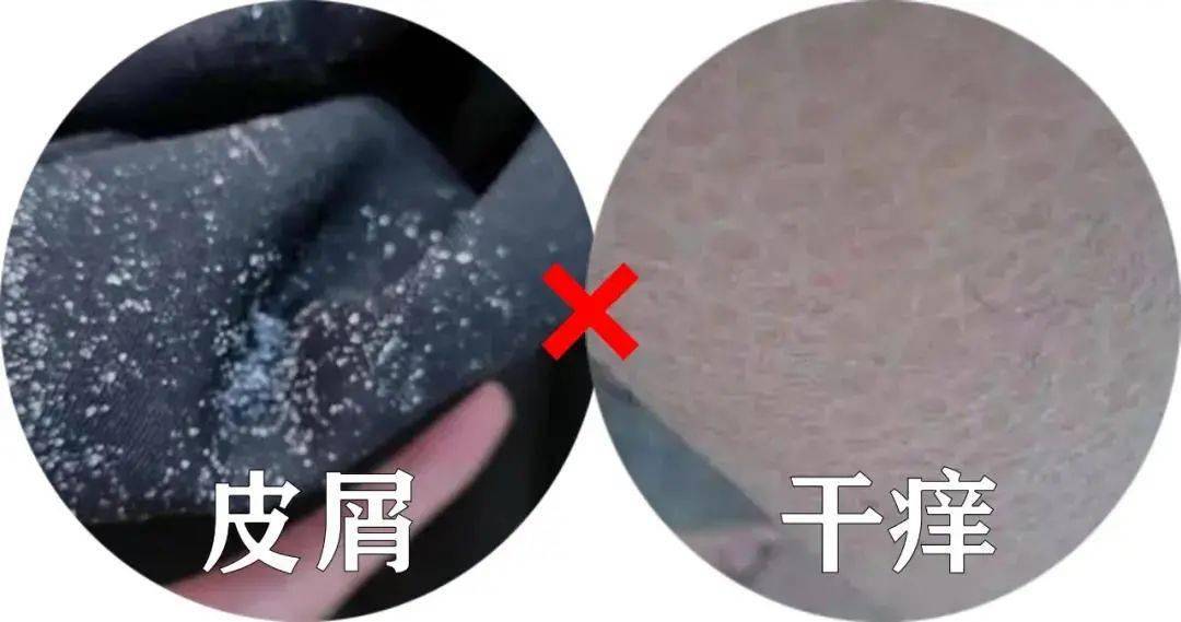 南宁这瓶身体乳还不入手？保湿+锁水+祛痘印！【1074主播严选商城】