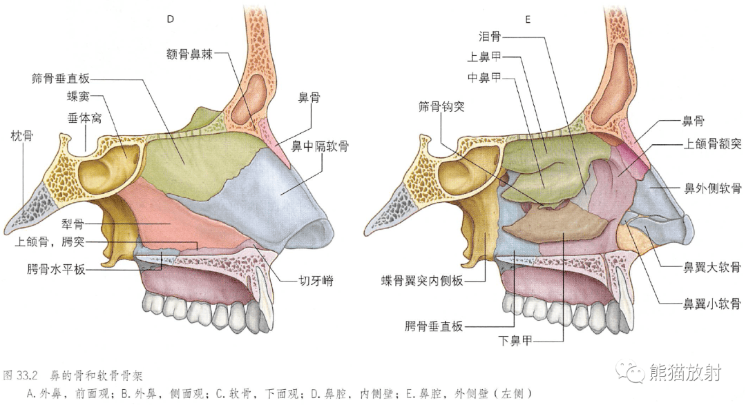 慢性鼻竇炎的ct評估【解剖】面部冠狀ct斷層及骨骼間隙(雙語)解剖丨鼻