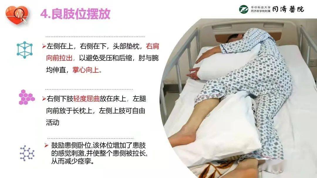 ppt一例脑卒中患者的护理查房