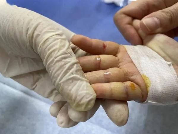 章红英|杭州2岁女童反复患病入院！爸爸说出“秘密”，妈妈崩溃…