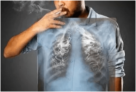 什么|一亿人都患的慢性病——慢阻肺，你不得不防…