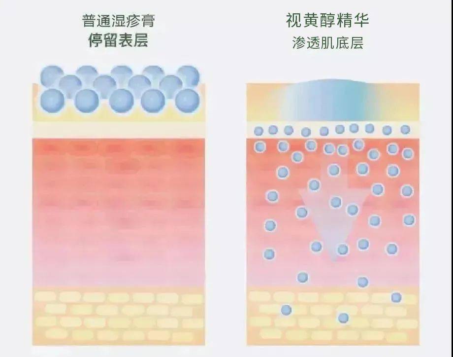 效果长了脂肪粒到底挤不挤?一分钟教你处理它的正确姿势!