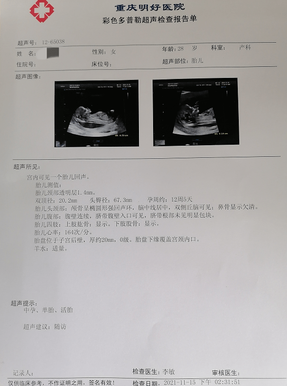一个孕囊b超图图片