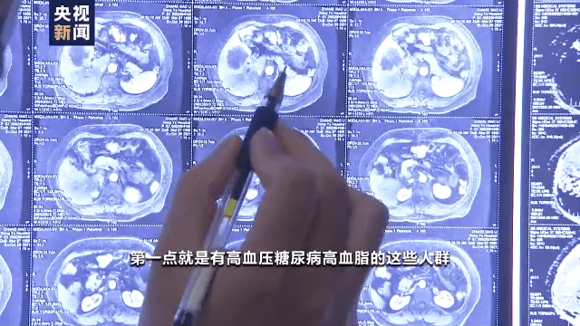 关节|转给家人！天气变冷 小心“冻”出这5种病