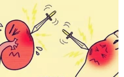 治疗|血液灌流，过敏性紫癜患儿的新选择