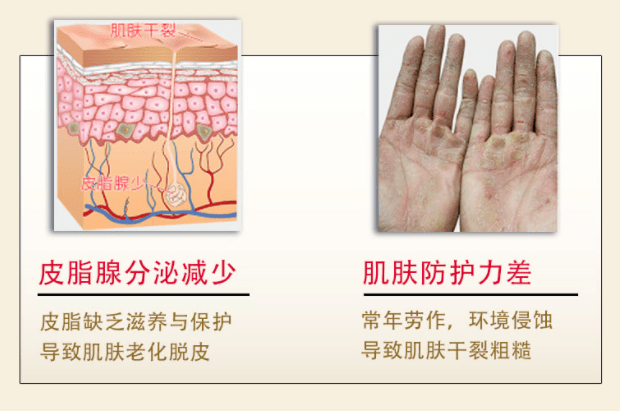 液体黄金百肤邦维E尿素霜两件立减6元！限时加赠橄榄油唇膏！滋润一整个秋冬！