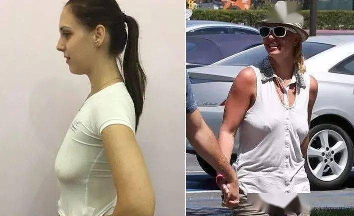 做过一档为期3年的调查发现 不'穿文胸的女性 没有了聚拢承托力