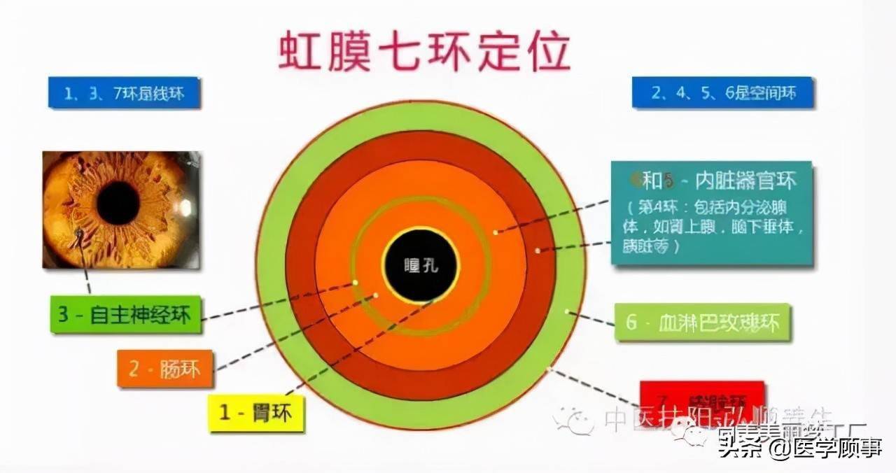虹膜诊断与五脏六腑的关系