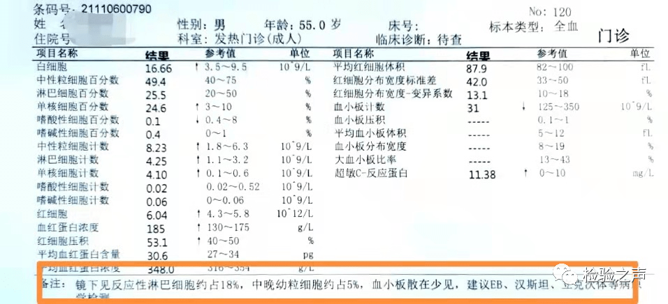 【檢驗案例】白細胞散點圖灰區_淋巴細胞_血小板_粒細胞