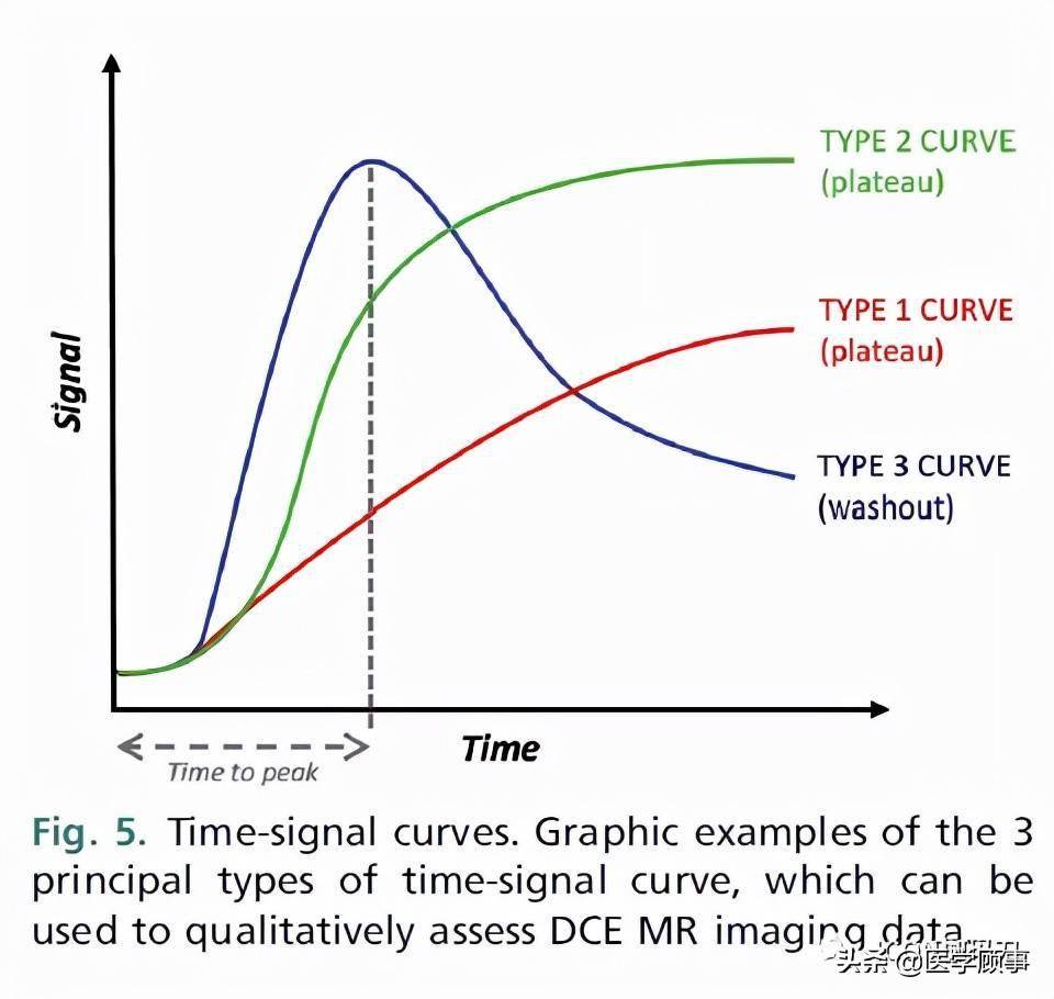 对颅神经和颅底的新的和先进的磁共振成像诊断成像技术评估