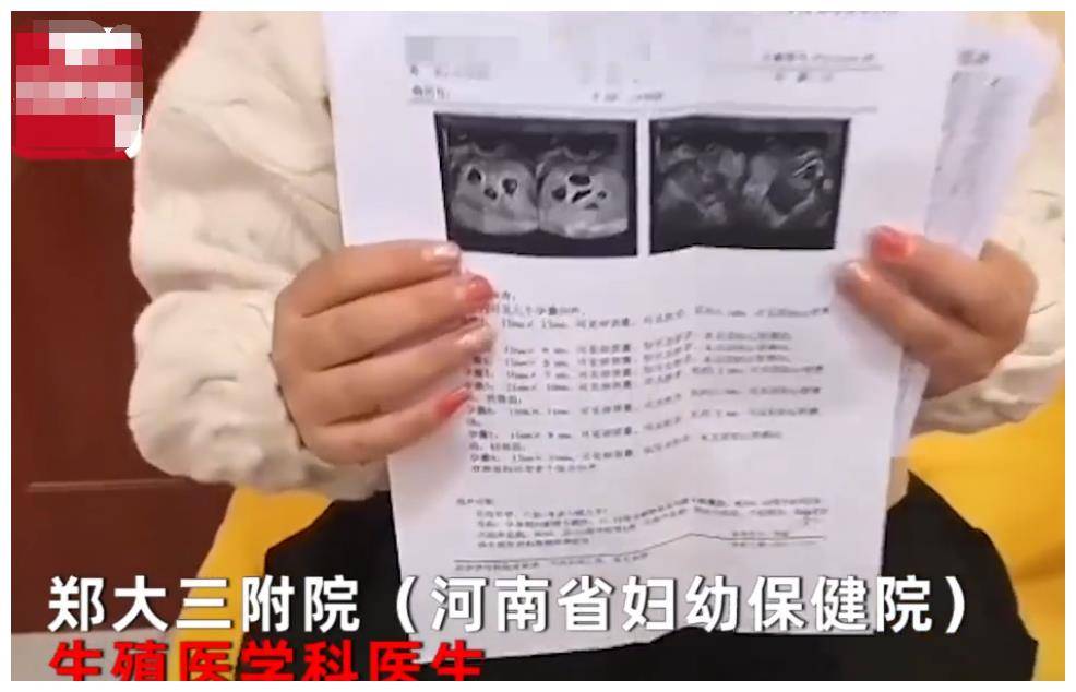 怀孕怎么看是几胞胎 b27e66315e60431cb4dc513b23730acd.jpeg