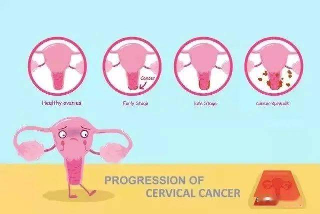 检查出 hpv 阳性会得宫颈癌？还能打疫苗吗？