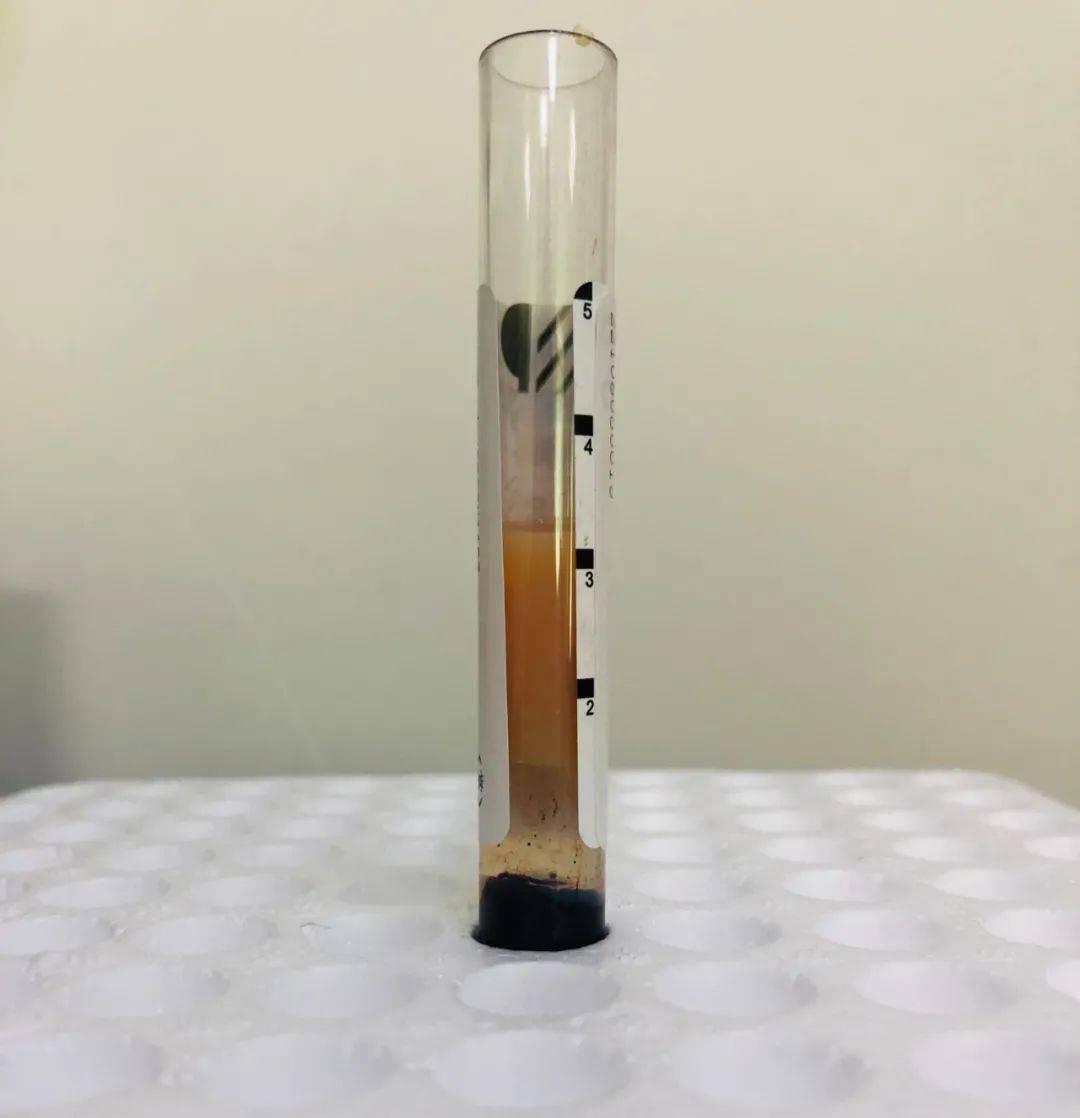 淀粉酶检测时间为全天24小时,急诊检测1小时内可出具报告.供稿:检