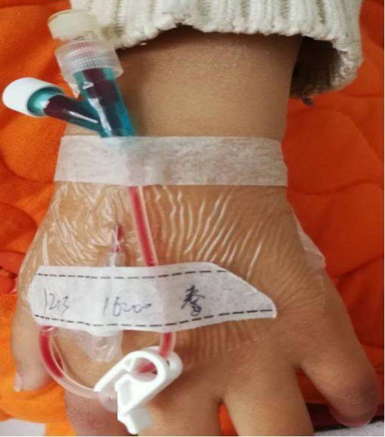 质控发现静脉留置输液竟有这么多问题!