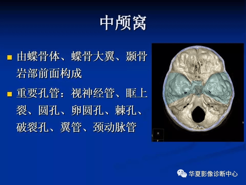 实用、详细的颅底各孔道影像解剖_结构_动脉_神经