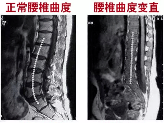 抹腰了怎么办