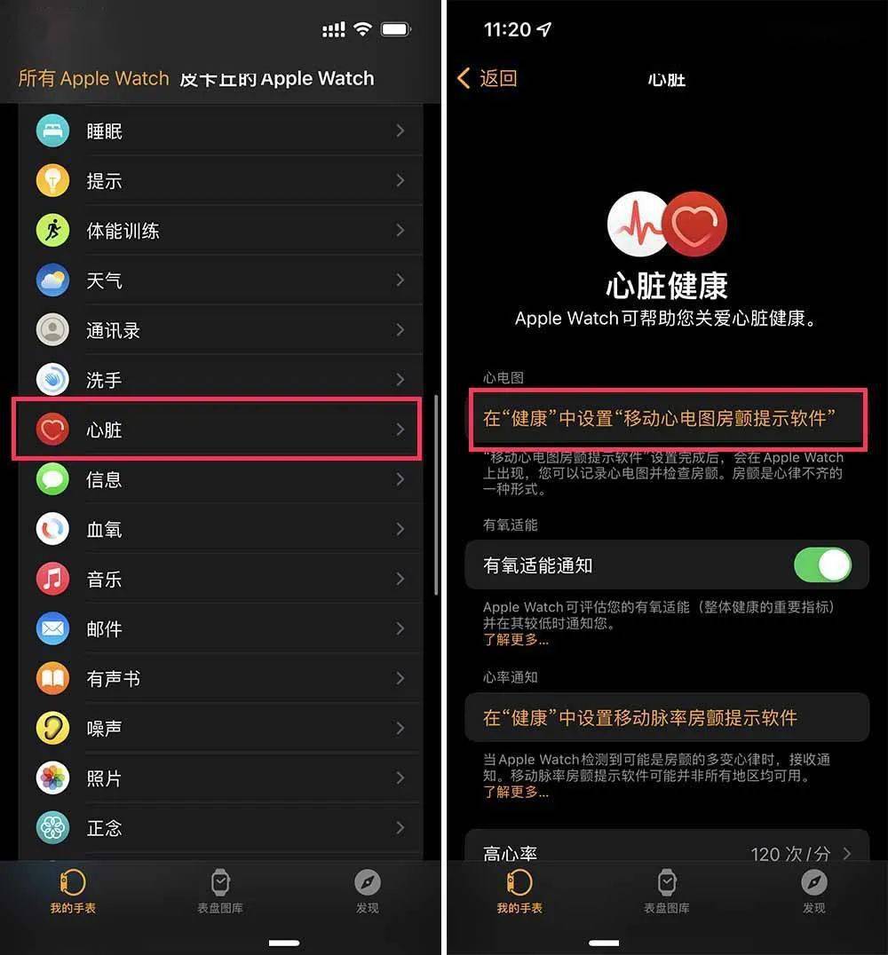 移动|等了 3 年，国行版 Apple Watch 心电图功能终于来了！