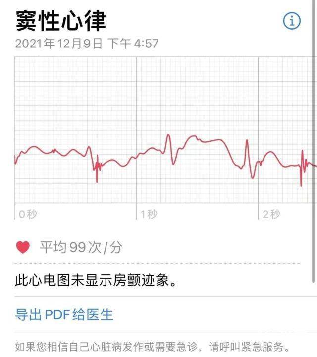 时隔三年！苹果手表「心电图」功能解锁，支持4款机型，快来看你的能不能用...