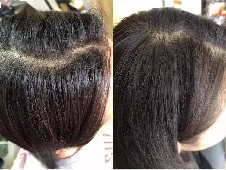 产品女人坚持喝它，肌肤白1度，色斑，暗沉通通消失，皮肤水嫩光滑，别怪我发晚了