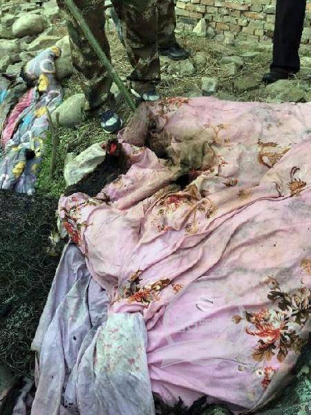 电褥子起火男子被烧伤巨额治疗费难倒一家人