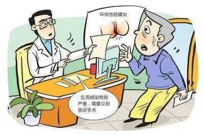 肛肠科致死病坏死性筋膜炎