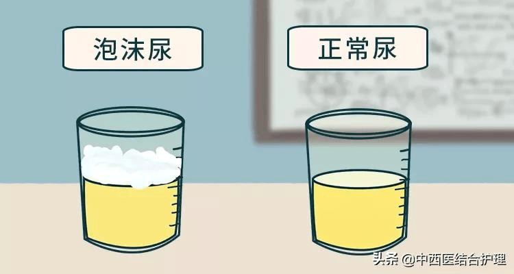 2,看透明度正常尿液澄清透明,如排出的尿呈混浊状,静止后均匀沉淀多半