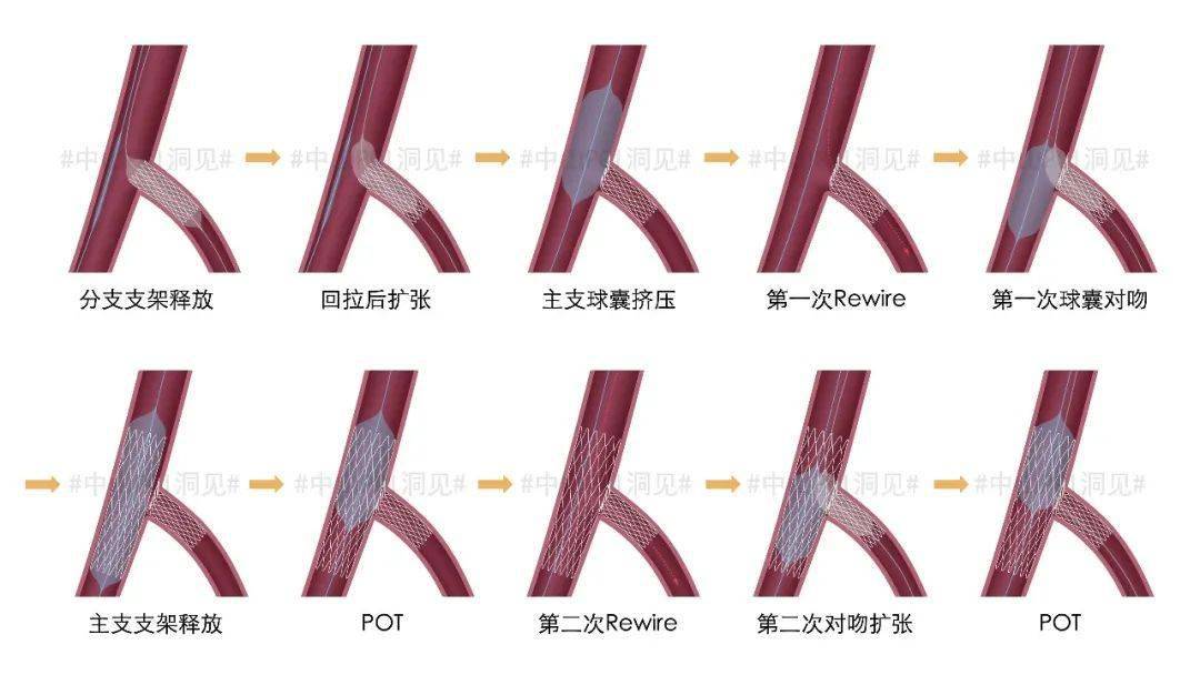 流程crush流程图culotte流程图从它们的具体过程来看,共分为10个步骤