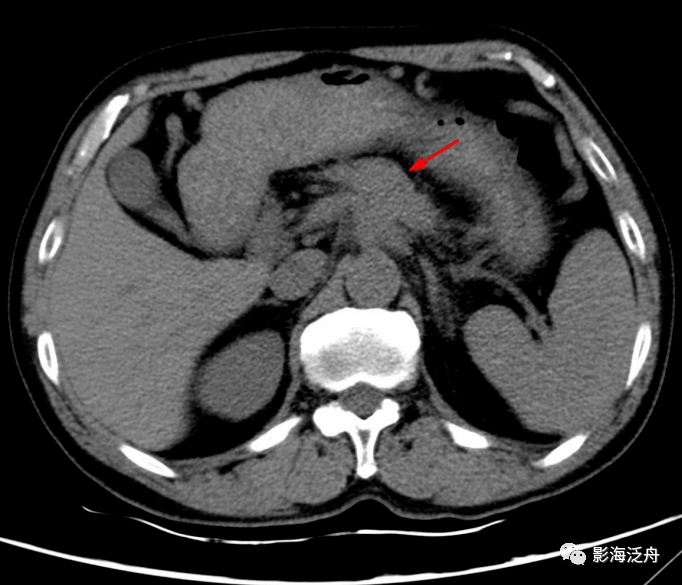 静脉|影像阅片，千万不能“掐头去尾”