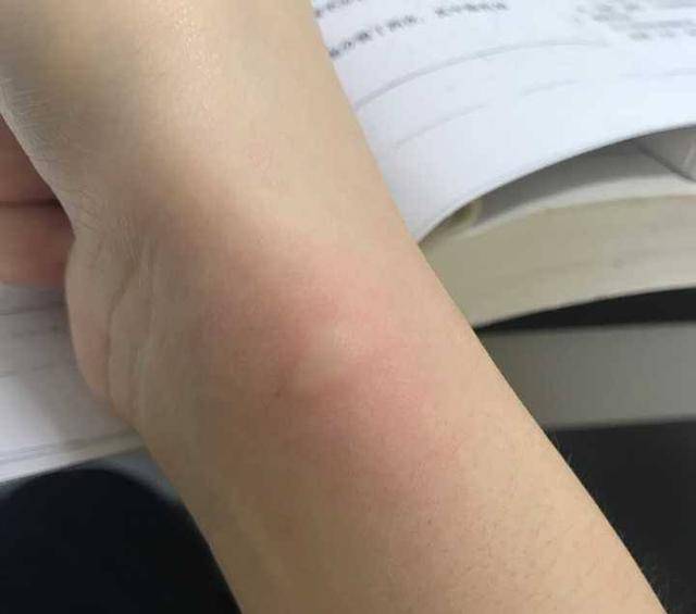 伊蚊_白纹_吸血