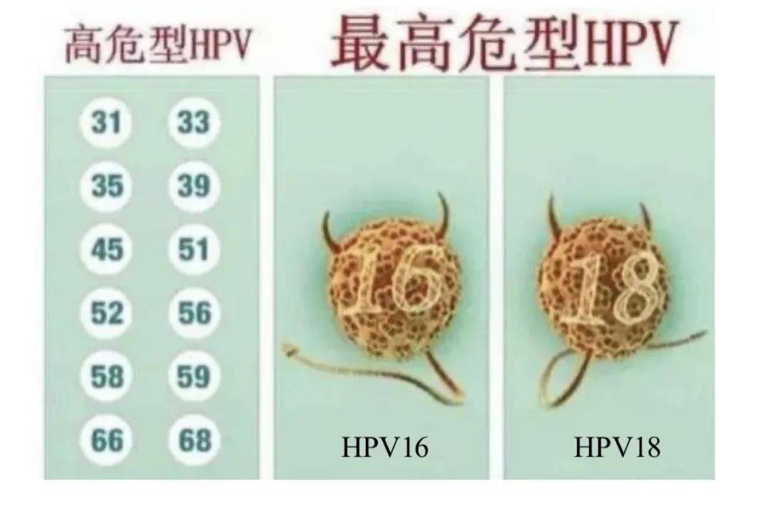 hpv阳性报告单图片