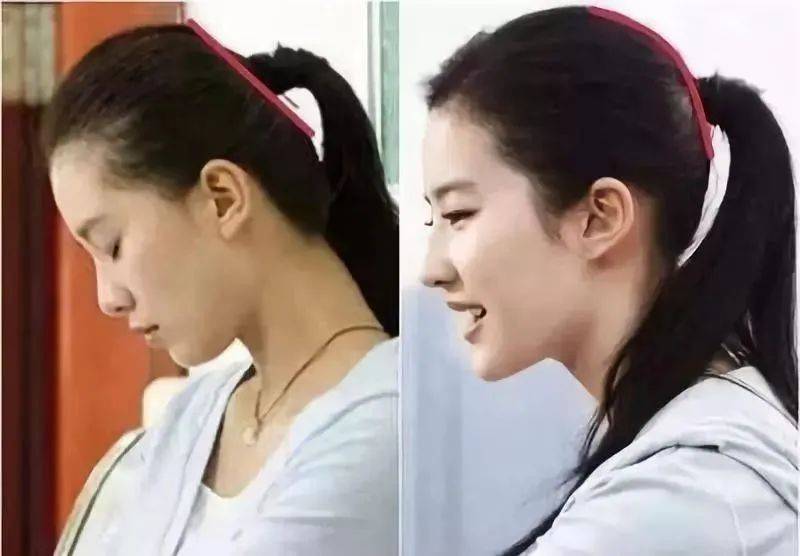 为什么范冰冰、刘诗诗扁头却依然五官立体?扁头一定就是睡出来的吗?_迪纳里克_头型_面型