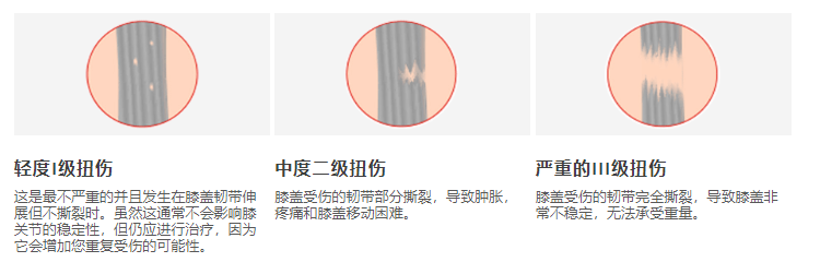 膝关节韧带损伤acl Pcl Mcl Lcl 膝盖 治疗 运动