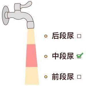 影響|體檢進行尿常規檢查，怎樣一次就能留取合格的尿標本？