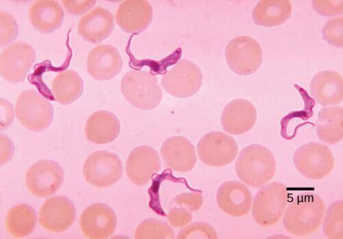 疟原虫厚血膜图片