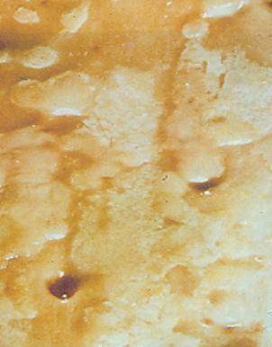 症状|@三高人群，怎样远离心梗/脑梗的威胁？