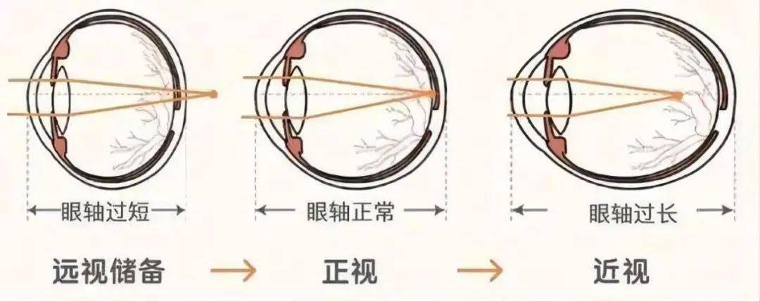 每人天生有笔存款限18岁前用答案在眼睛里