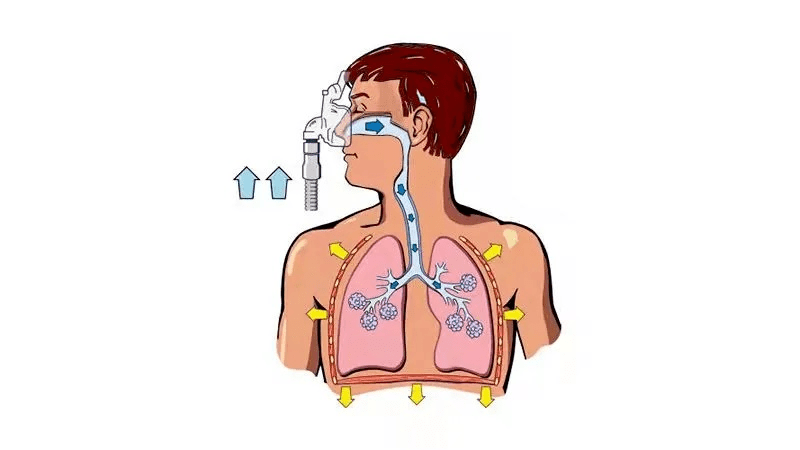 呼吸机插画图片
