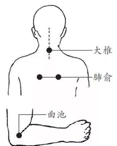 中医分享:艾灸可调理恶寒无汗,高烧不退(医案)