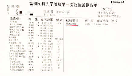 要提醒大家,不只是孩子会感染eb病毒,抵抗力差一些的成人也会被感染