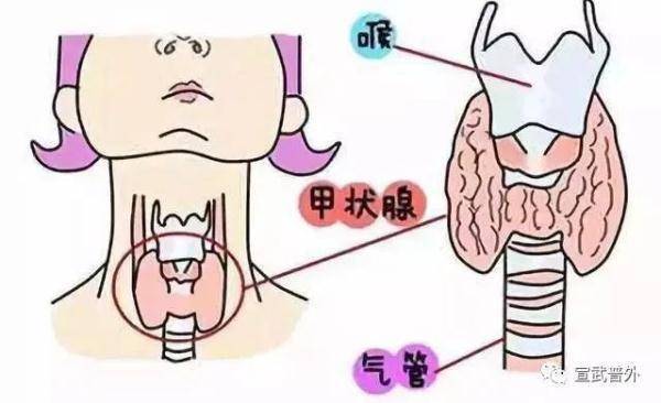 黏液|怕冷又怕热的小蝴蝶—甲状腺