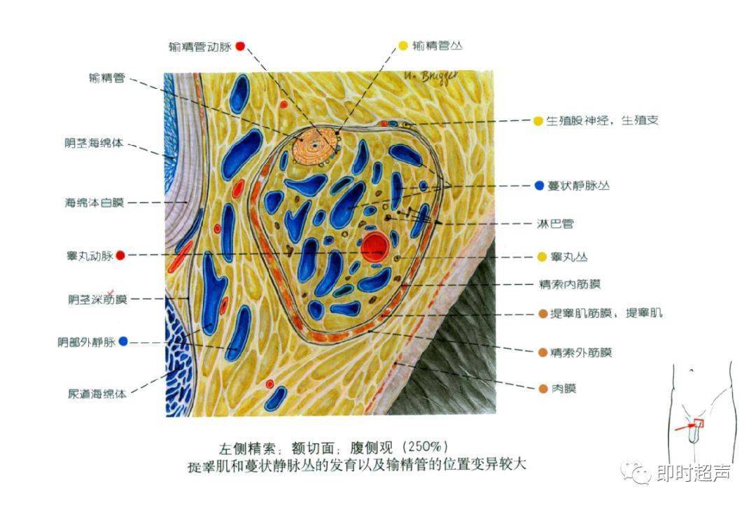 蔓状静脉丛图片