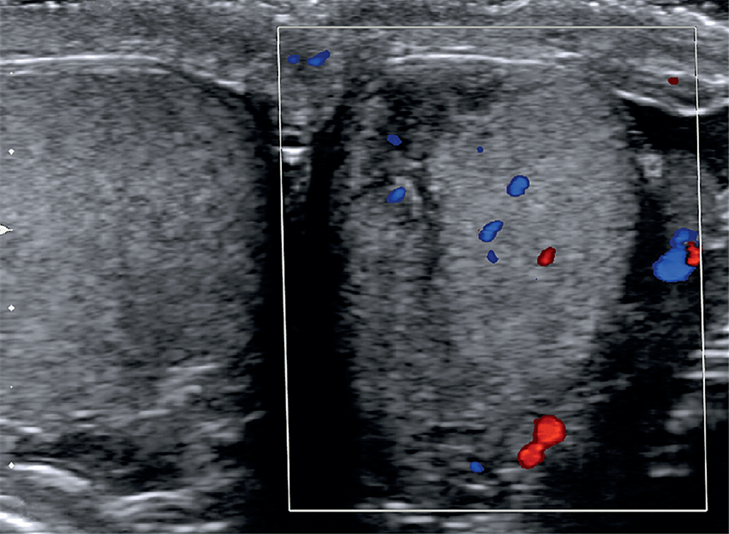 2022新年快乐读书笔记一起聊聊睾丸外伤字数1300