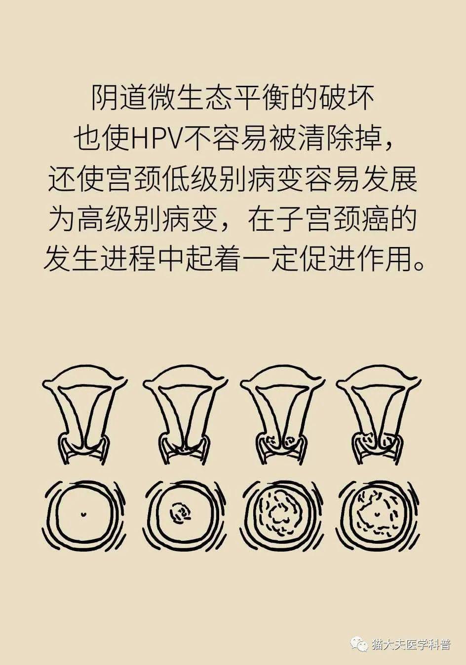 阴道炎会导致宫颈癌吗