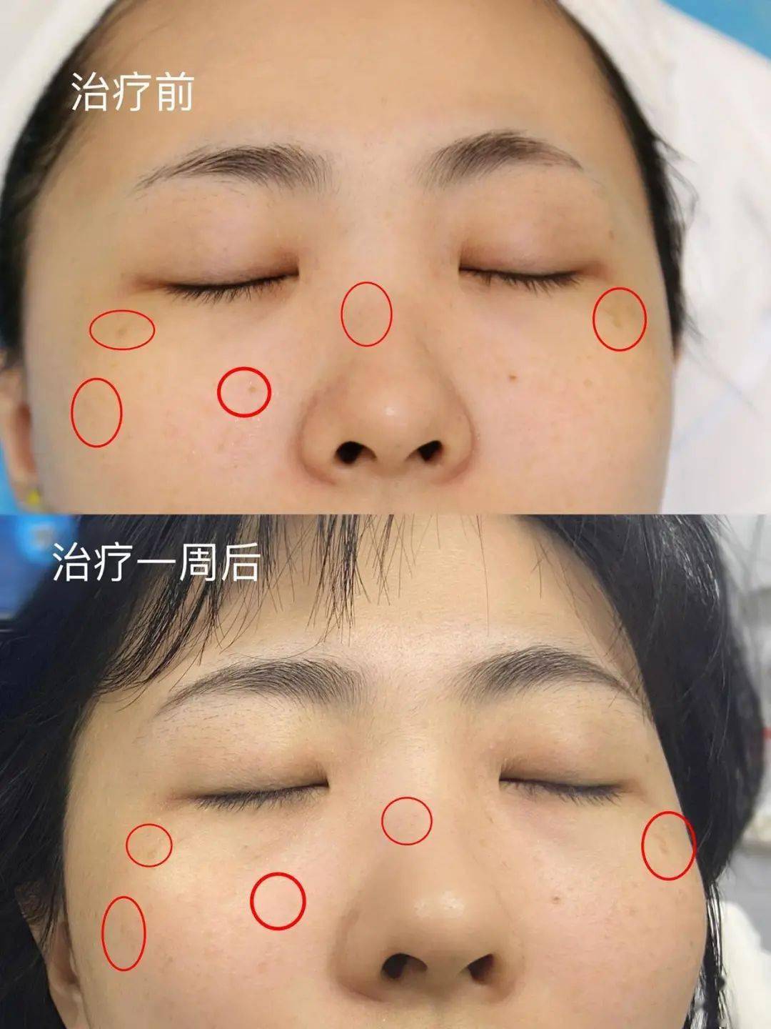 机器欧美明星罕见素颜照大盘点,最美竟是她?曝光美肤秘诀!