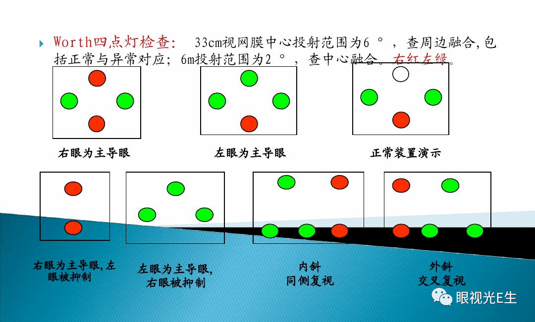 为什么要进行worth 4点灯检查?