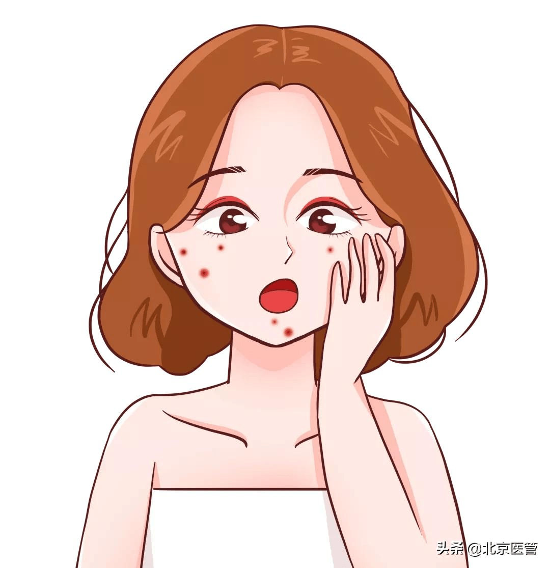 避孕药还能治疗痤疮防痘有什么需要注意的