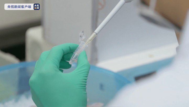 通过指纹可发现唐氏综合征，我国表型组研究获重大突破