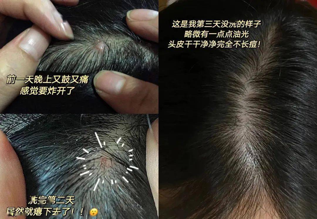 怎样能让头发油得慢一点 4ff3f83add924b9abf43daac72222b2c.jpeg