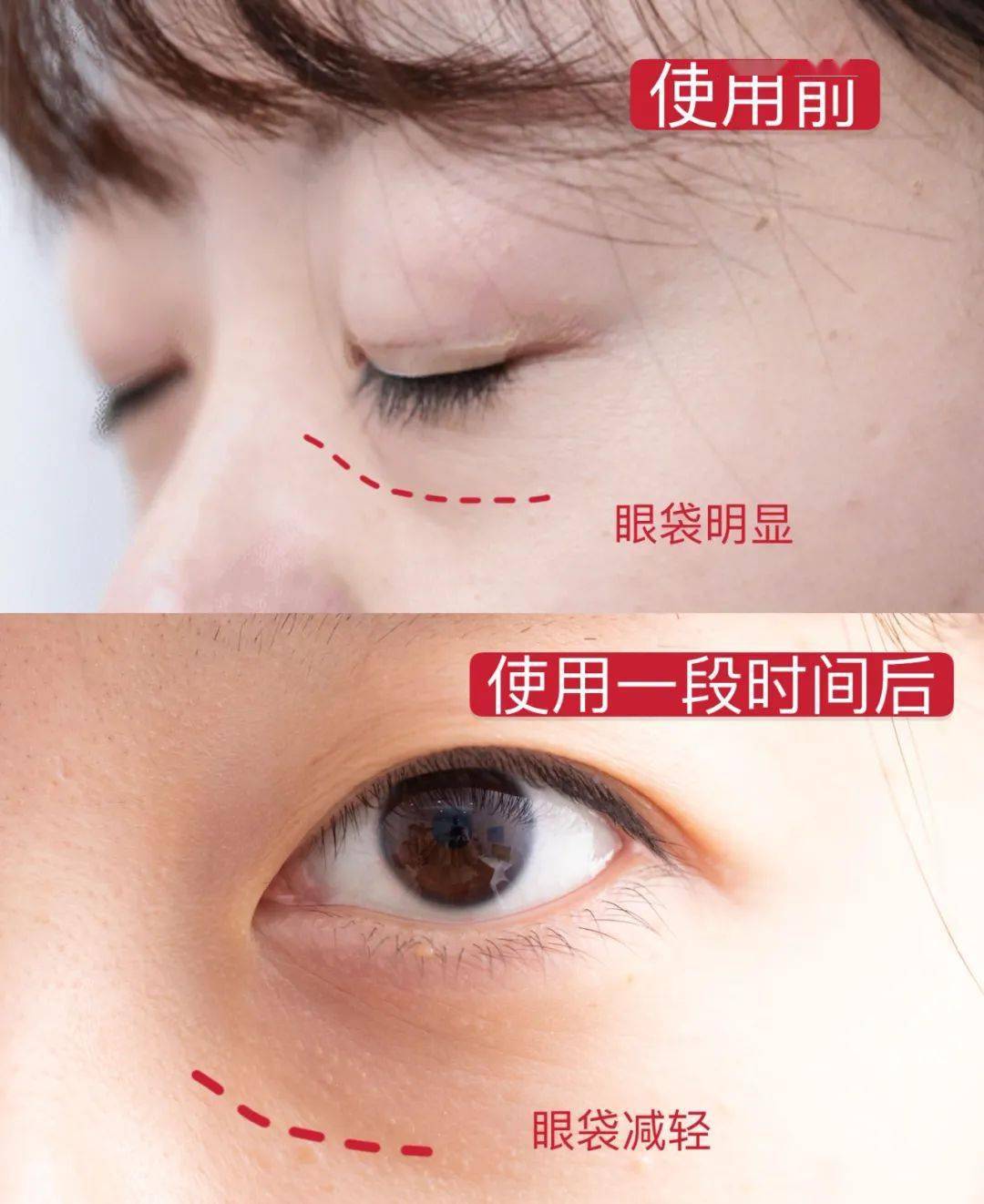眼睛惊到我了！“马应龙去眼袋那个视频，竟然是真的！”
