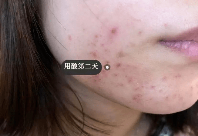 黑头翻车震惊全网的阿娇，高调复出后脸都变了？？？
